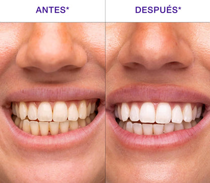 2X1 WHITEFLASH™ – Dientes Visiblemente Más Blancos en 30 Minutos